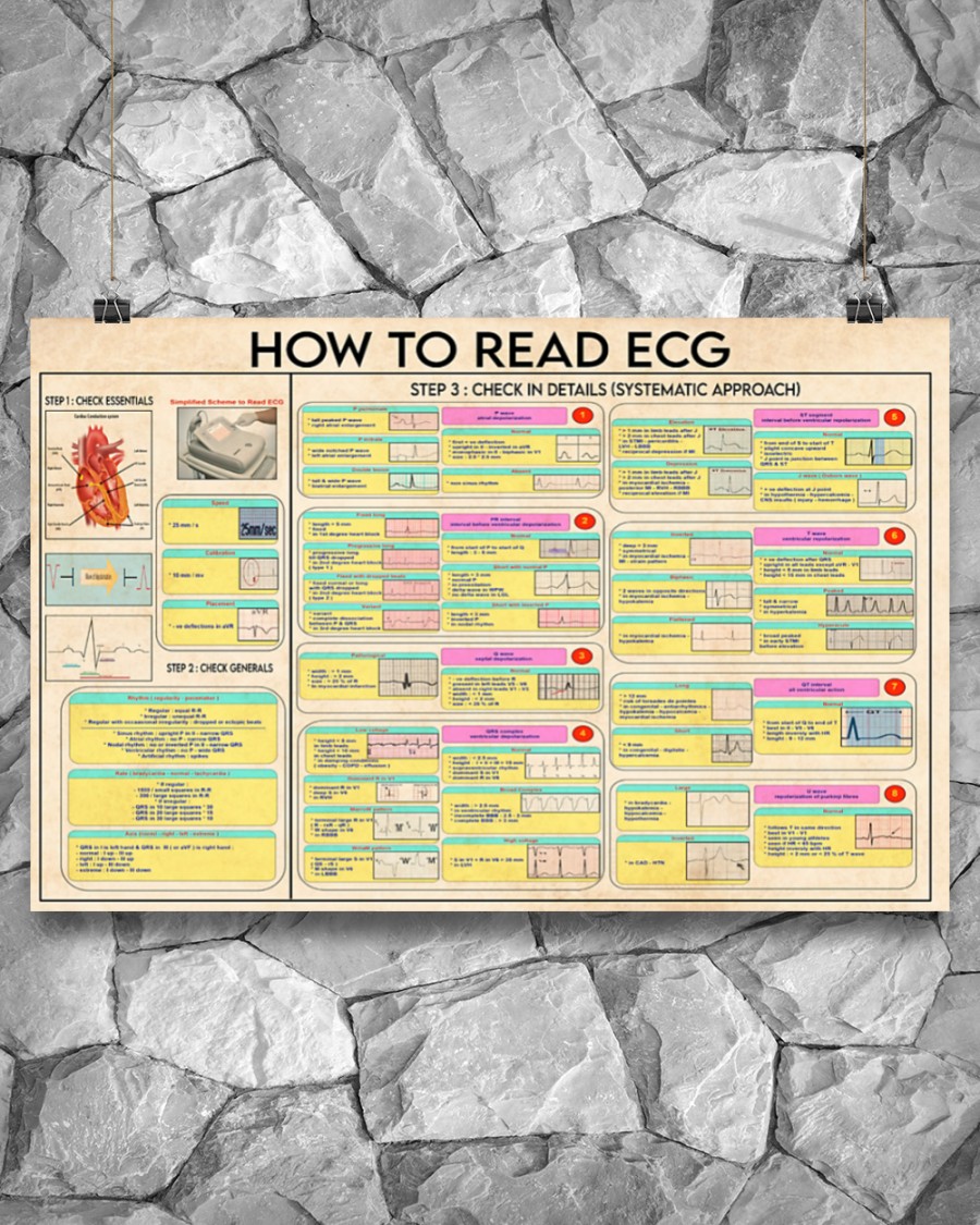 Cardiologist how to read ecg poster 3 Cardiologist how to read ecg poster