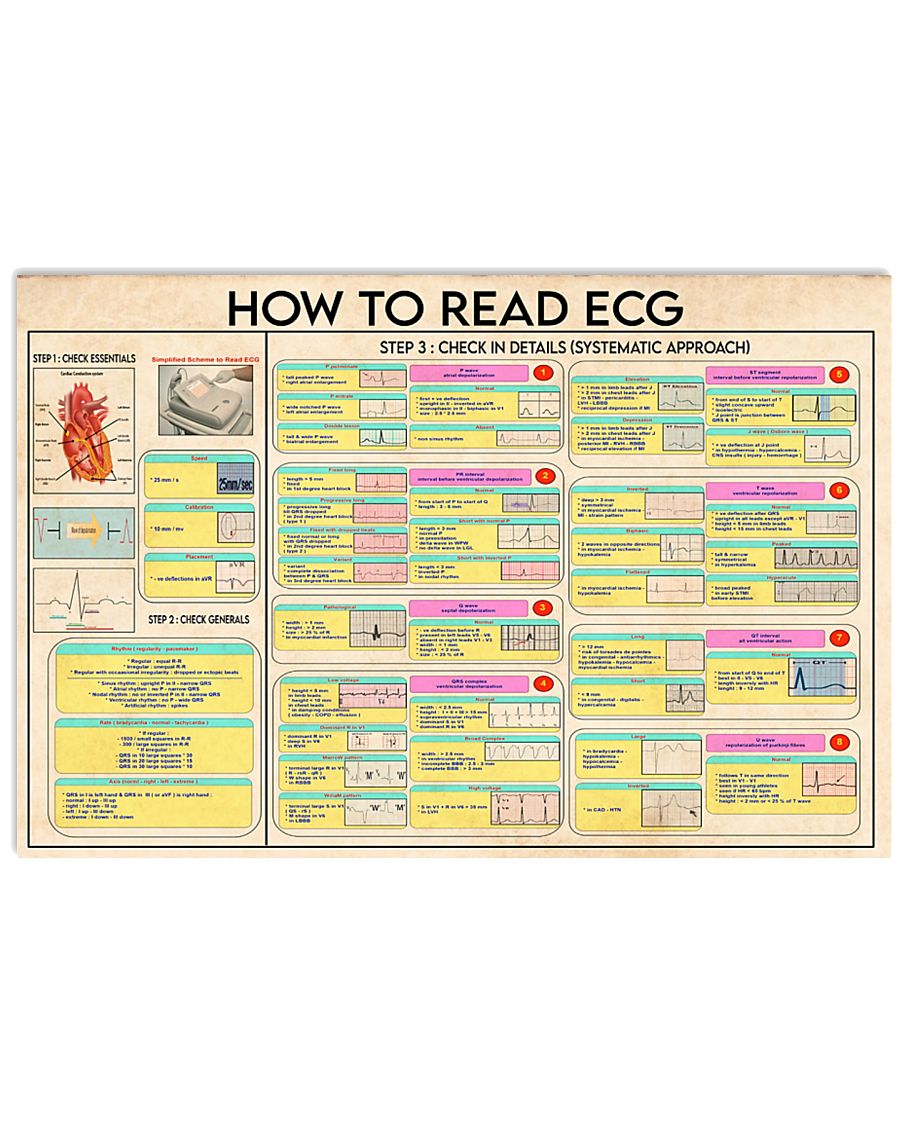 Cardiologist how to read ecg poster